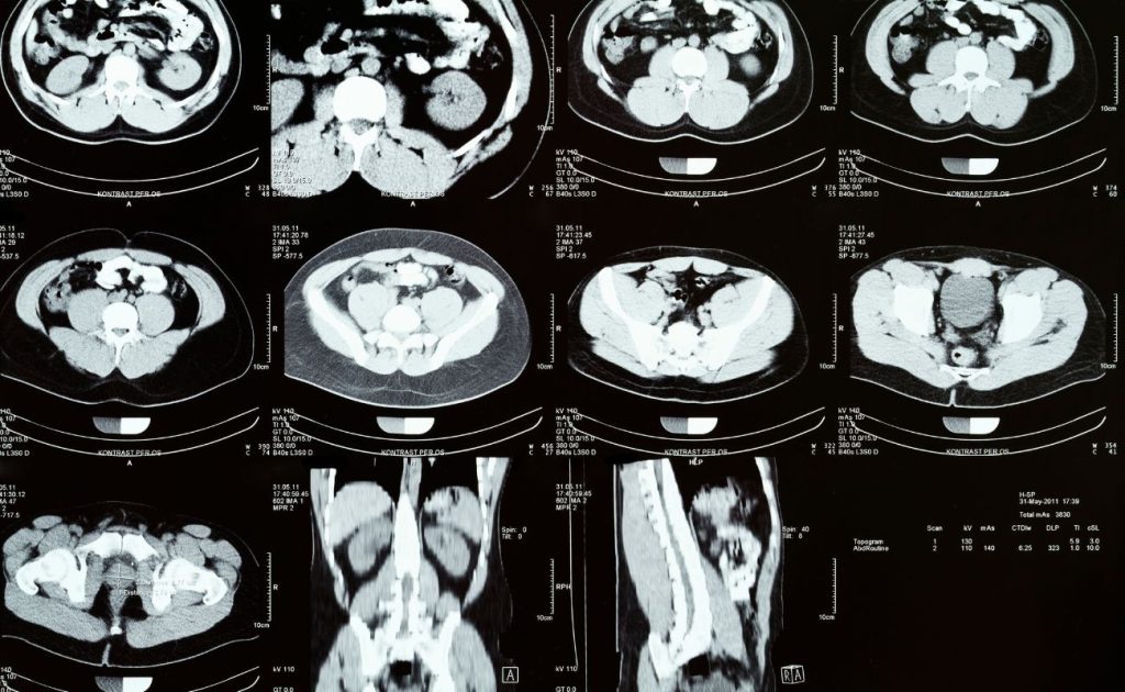 tomografia de abdomen en merida precio