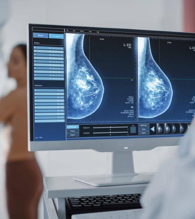 realizacion de mamografia en merida yucatan